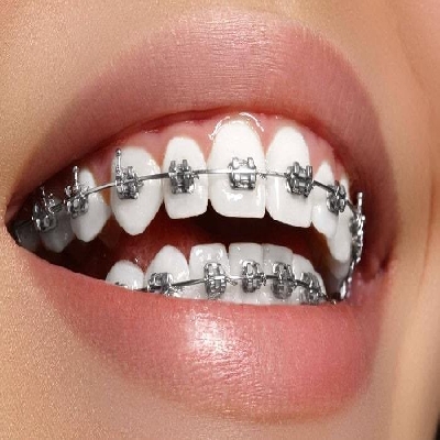 Pediatric Dentist in Thiruvalla